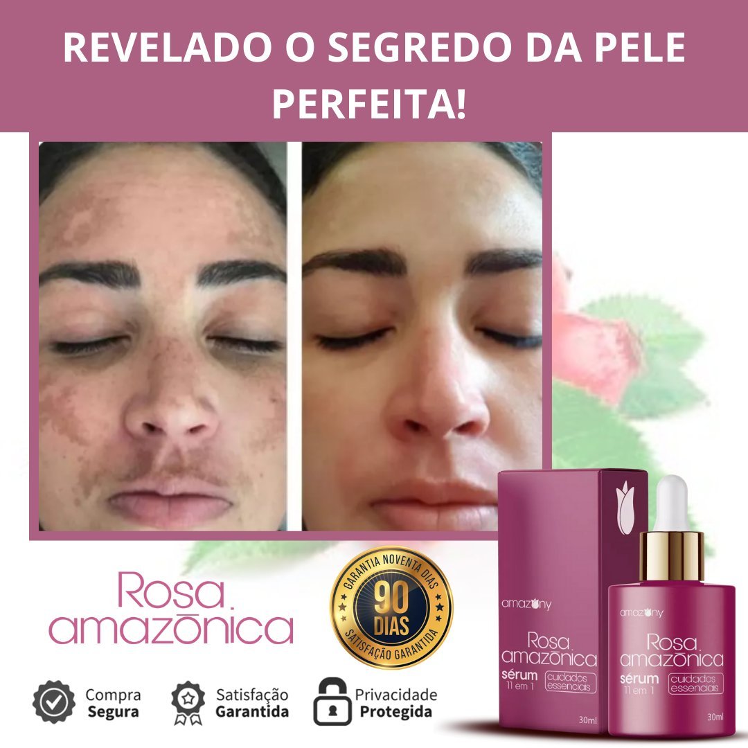 Rosa Amazonica Comparativo